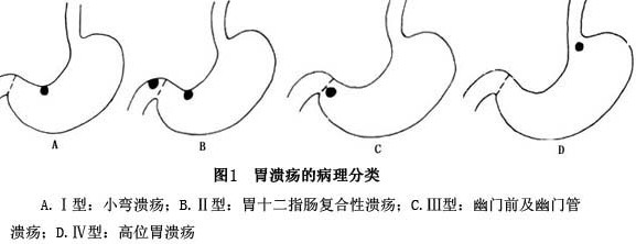 θ