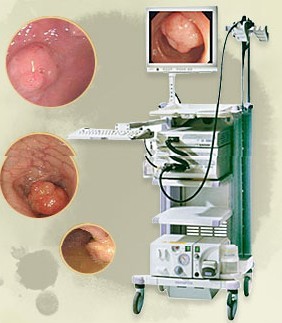 奥林巴斯胃镜怎么用＂胃病检查金标准＂--奥林巴斯无痛电子胃镜_https://www.jmylbn.com_新闻资讯_第1张